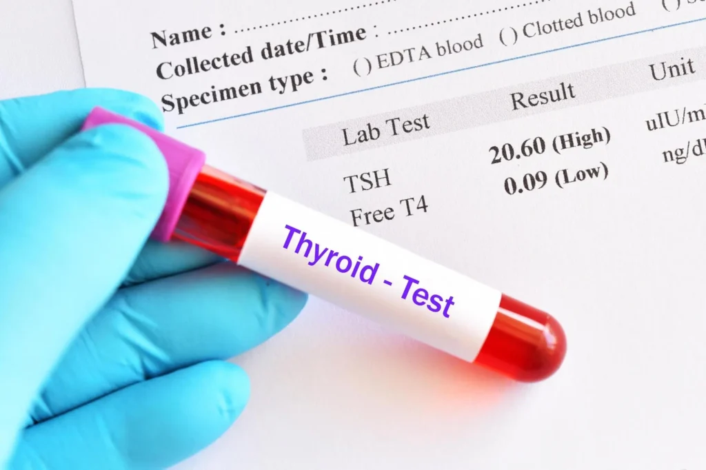 thyroid function tests thyroid function tests