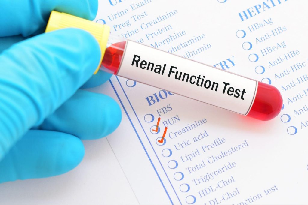 kidneys functions tests kidneys functions tests