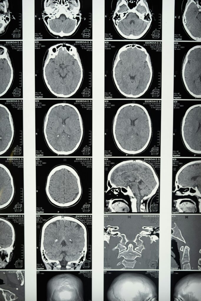 Best Neurology Clinics In Shivaji Nagar In 2025