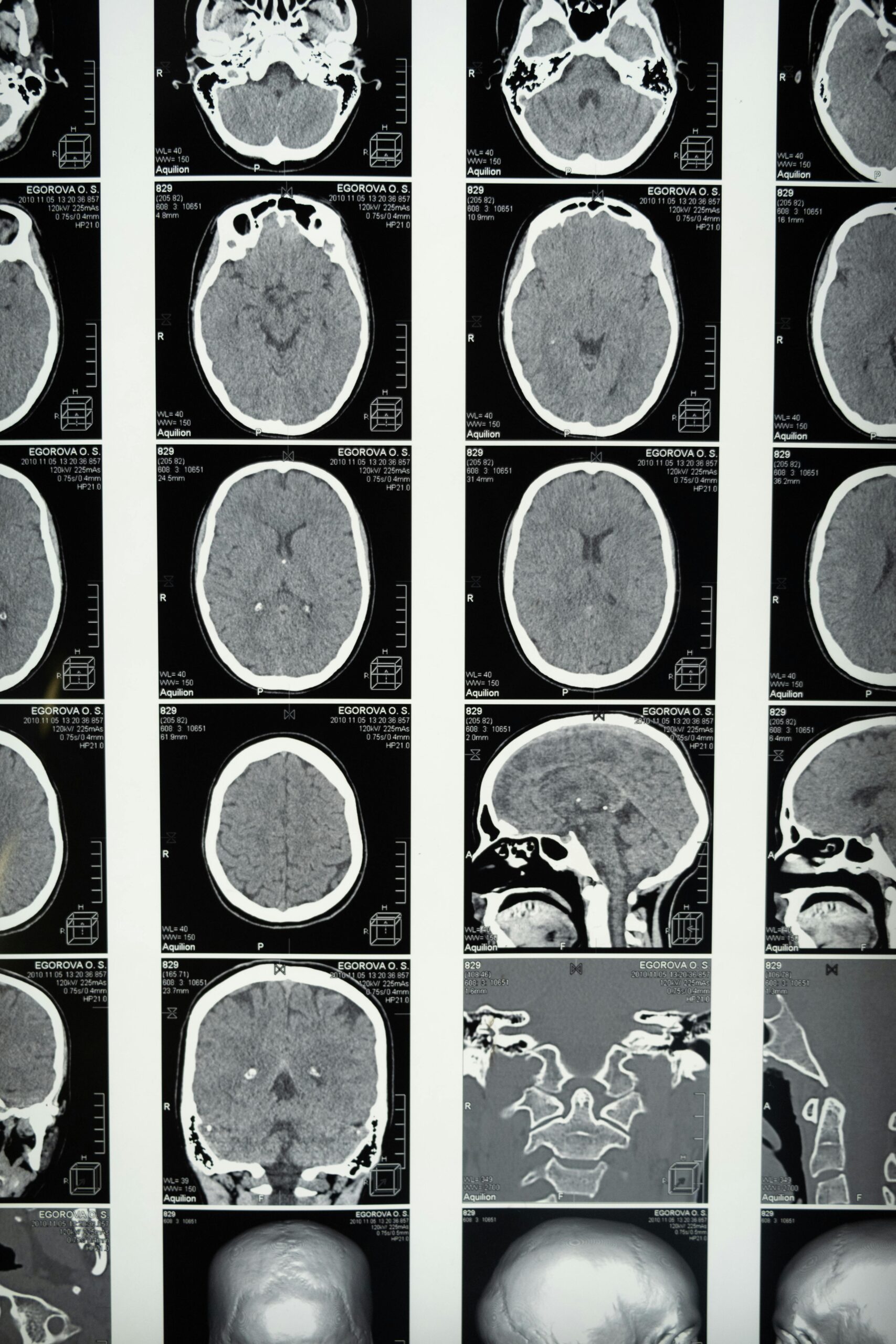 Best Neurology Clinics In Shivaji Nagar In 2025